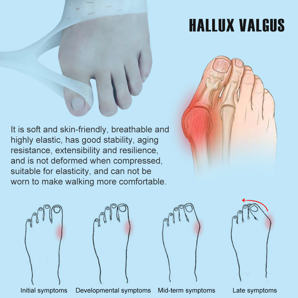 1Pair Silicone Bunion Correcto - Toe Separator Silicon review and price