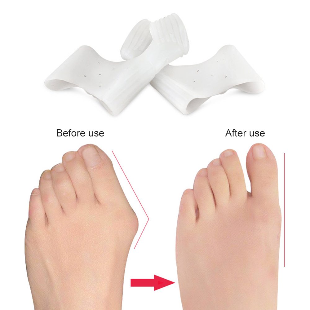 1Pair Silicone Bunion Correcto - Toe Separator Silicon review and price